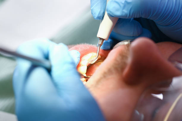 Best Emergency Gum Pain Relief  in Oildale, CA