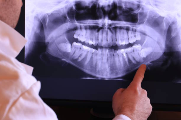 Best Chipped Tooth Repair Near Me  in Oildale, CA