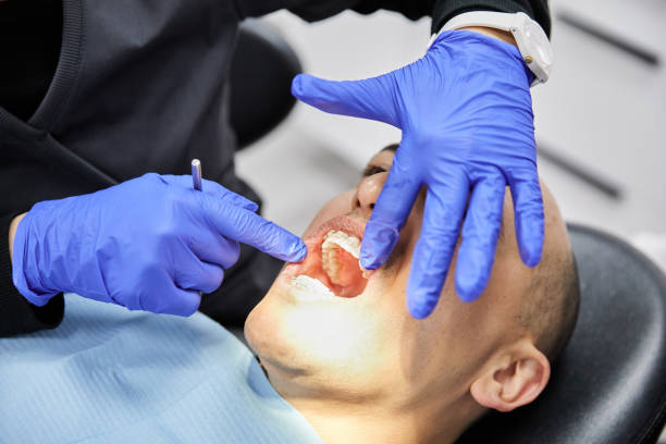 Best Dentist for Severe Toothache  in Oildale, CA
