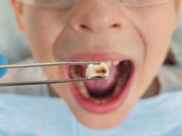 Best Emergency Pediatric Dentist  in Oildale, CA