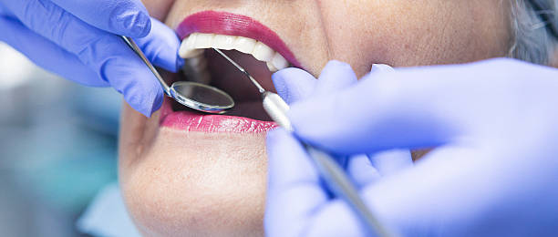Best Teeth Whitening  in Oildale, CA